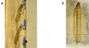oeuf de L. macrostigma sous loupe binoculaire