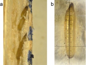 tude de l'oeuf de L. macrostigma sous loupe binoculaire